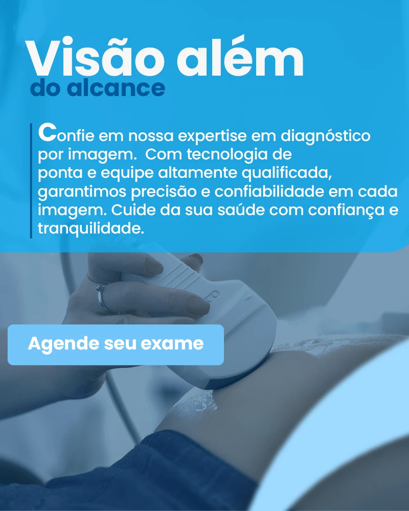 mobile visão alem do alcance copy2
